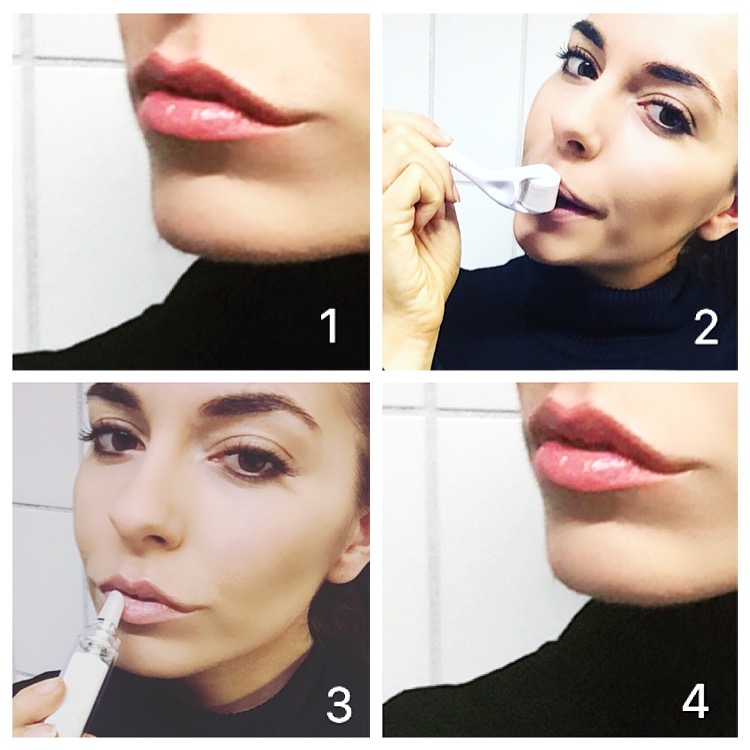 Micro Needling At Home With Walberg Cosmetics Caterina Catalano S Fashion Blog And Website